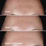 سرم ضدچروک قوی کلینیک مدل Smart Clinical Repair حجم 30 میل - Image 4