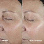 سرم ضدپیری کلینیک مدل smart clinical repair حجم 50میل - Image 2