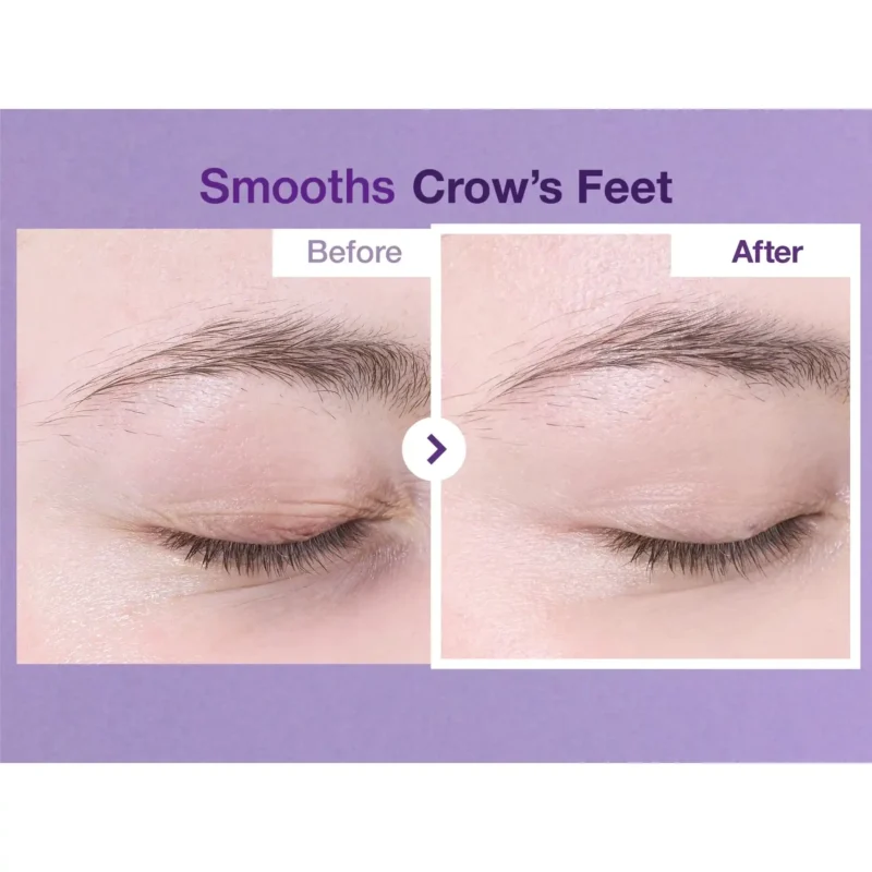دورچشم ضدچروک و تیرگی نامبوزین شماره 9 Volumetox - Image 5