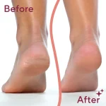 پدیکور برقی فاولس Pedi Electronic Pedicure Tool - Image 5