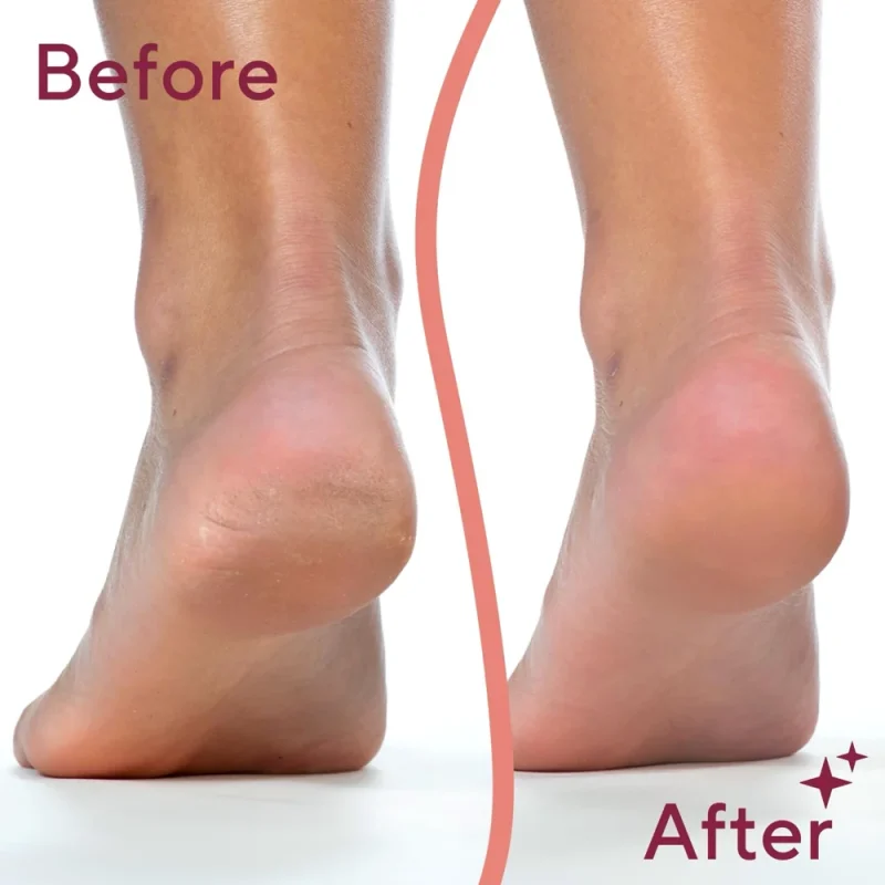 پدیکور برقی فاولس Pedi Electronic Pedicure Tool - Image 5